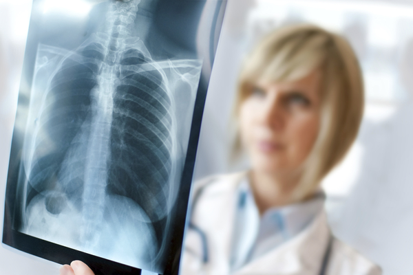 Key Things You Should Know About Filing a Mesothelioma Lawsuit