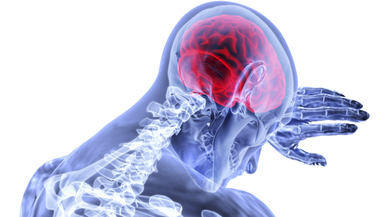 Brain Injury: You May Be Compensated